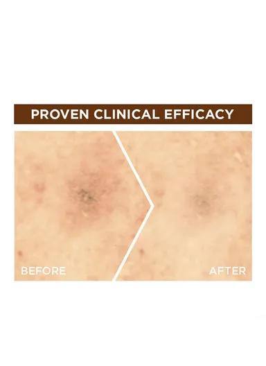 30ml Fast Bright 10% Pure Vitamin C Brightening Overnight Serum - 30ml