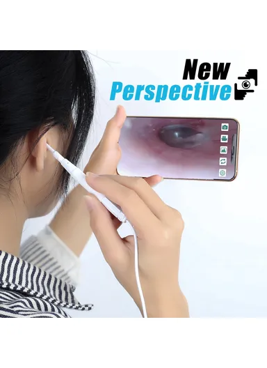 3-in-1 0.39cm Otoscope Camera Ear Scope Endoscope Ear Wax Removal Tool AN103 (App: AN CAMERA) - White