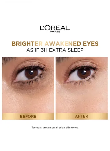 Glycolic Eye Serum [3% Glycolic Acid + Vitamin CG + Niacinamide] For Dark Circles, Brighten Eyes 20ml