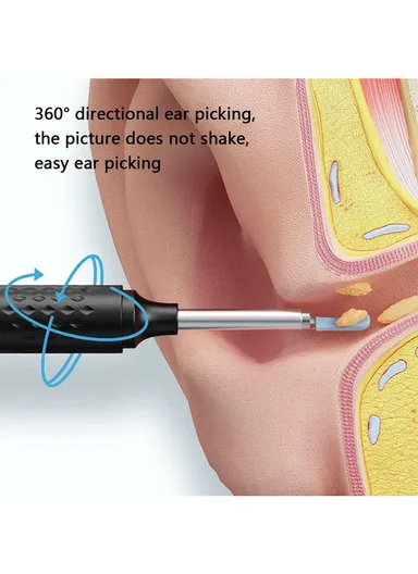 Earwax Remover WiFi Visual Otoscope with LED Lights Phone App Monitoring N3 PRO-B 