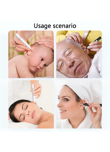 Earwax Remover WiFi Visual Otoscope with LED Lights Phone App Monitoring N3 PRO-B 