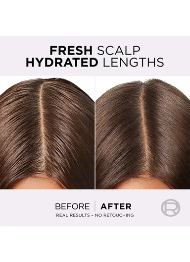 Elvive Hyaluron Pure 72h Rehydrating Conditioner for Oily Scalp &amp; Dehydrated Lengths -200ml