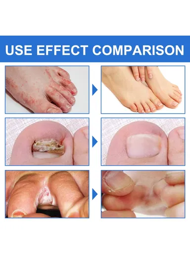 1 Pair Anti Bunion and Varicose Vein Non-Slip Moisturizing &amp; Soothing Skin Tourmaline Socks HKB05-A018-1-BK1