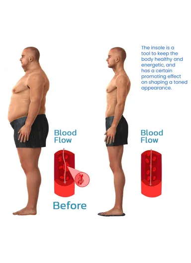 1-Pair Arch Insoles, Varicose Veins Relieve Magnetic Acupressure Arch Support Insoles
