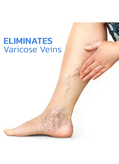 1-Pair Arch Insoles, Varicose Veins Relieve Magnetic Acupressure Arch Support Insoles