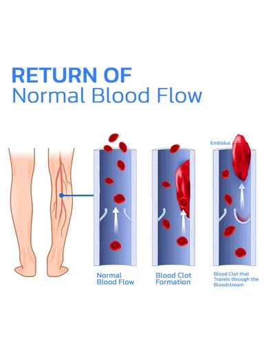 1-Pair Arch Insoles, Varicose Veins Relieve Magnetic Acupressure Arch Support Insoles