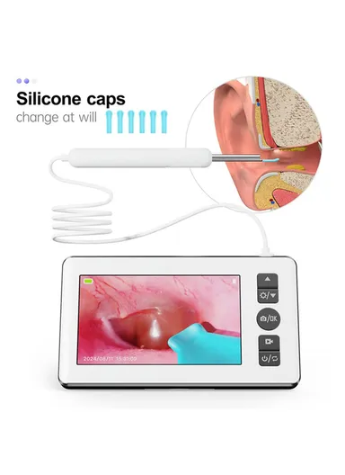 4.3-inch HD Visual Ear Cleaning Endoscope Professional Otoscope Ear Wax Removal Tool N18