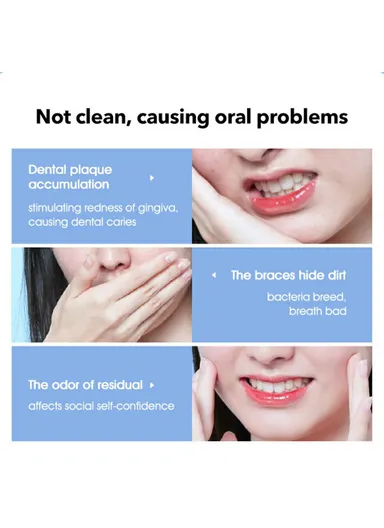 700mAh Rechargeable Teeth Cleaner Oral Irrigator, Portable Waterproof Toothpick Oral Cleaning Tooth Whitening 360-degree Rotary Nozzle YOUPIN SOOCAS W3 Pro 