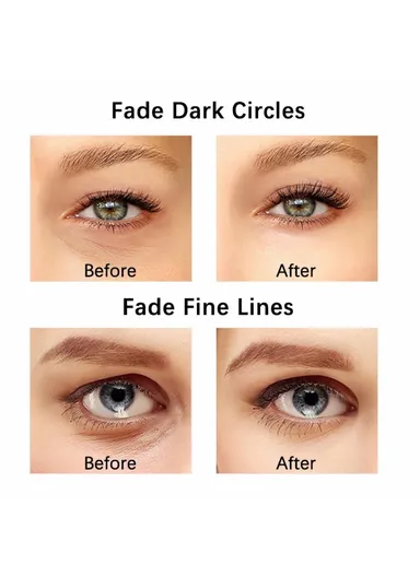 EMS Microcurrent Heating Eye Cream Introducer Eye Massager Beauty Device YA-113 - Pink