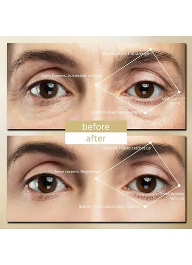 2 In 1 Makeup Mirror Eye Care Patches with Charging Case Anti-Wrinkle Eye Massager