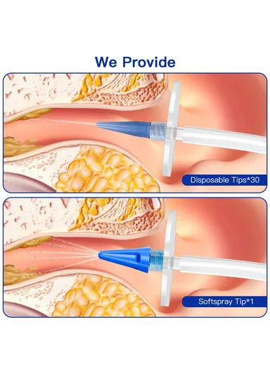 Manual Ear Washer Ear Wax Removal Kit Home Ear Flushing Tools W10 - Green