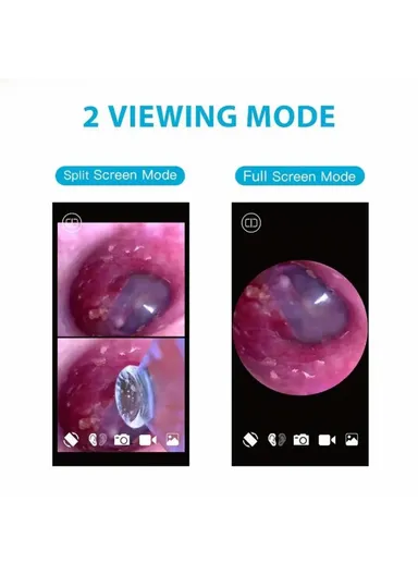 3.9mm WiFi Visual Otoscope Ear Endoscope Camera Ear Wax Cleaner Camera SA39W