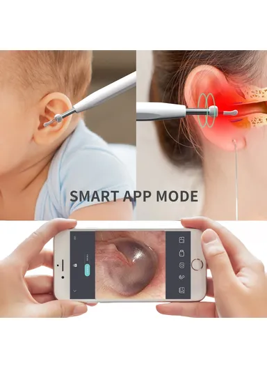 Ear Camera Otoscope Ear Wax Removal Tool Kit LED Light Ear Pick Spoon Earwax Remover W2 - Black