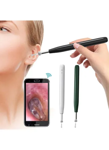 Ear Camera Otoscope Ear Wax Removal Tool Kit LED Light Ear Pick Spoon Earwax Remover W2 - Black