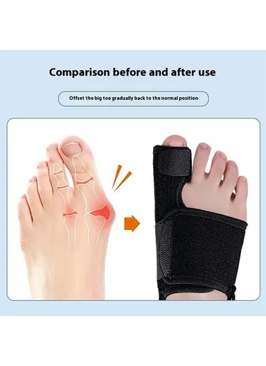 Bunion Corrector Adjustable Toe Separator Orthotics Feet Bone Thumb Adjuster Foot Care Tool 003 - Black / Left