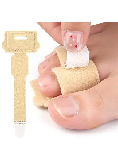 1Pc Toe Separator Bunion Corrector Big Toe Spacer Toe Straightener Built In Aluminum Plate 011 - Black