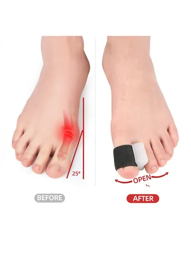 1 Pair Toe Separator Bunion Corrector Big Toe Bunion Straightener Pain Relief Alignment Aid Size S 114 - Nude