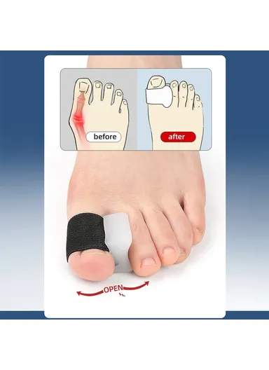 1 Pair Toe Separator Bunion Corrector Big Toe Bunion Straightener Pain Relief Alignment Aid Size S 114 - Black