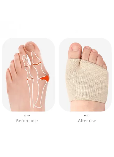 1 Pair Bunion Relief Sleeve, Metatarsal Pad, Gel Cushion Corrector, Slanted Threaded Foot Protector - Black / L