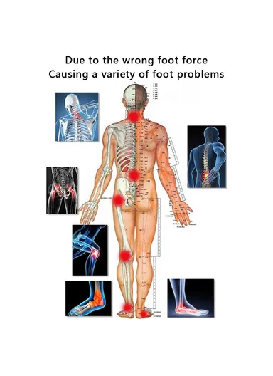 1 Pair TPR Flat Foot O-Shaped Legs Insole Arch Support Plantar Fasciitis Shoe Inserts - Black / Kid (28-34)