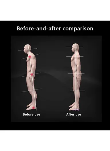 1 Pair TPR Flat Foot O-Shaped Legs Insole Arch Support Plantar Fasciitis Shoe Inserts - Black / Kid (28-34)