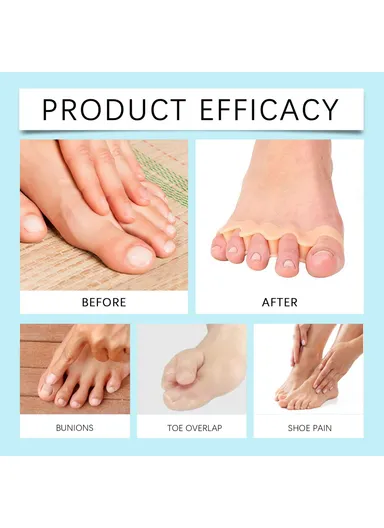 2Pcs Ergonomic Silicone Toe Separators for Toe Stretching Relaxation HK-B07-0132-01 