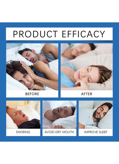 Anti Snoring Device Gentle Sleep Aid Comfortable Nighttime Breathing Support LA-B07-0047-01 