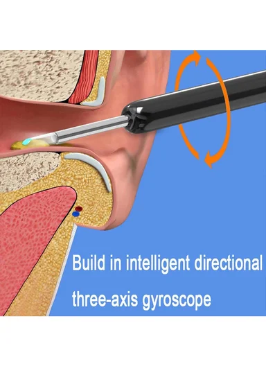 NE3 Smart WiFi Visual Ear Cleaner with 1080P HD Camera, IPX5 Waterproof 