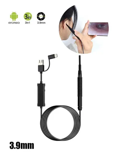 3-in-1 0.39cm Otoscope Camera Ear Scope Endoscope Ear Wax Removal Tool AN103 (App: AN CAMERA) - Black
