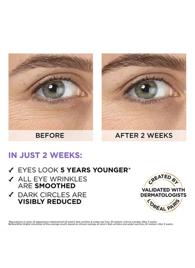 20ml L'Oreal Paris Hyaluron Expert Moisturiser and Anti-Aging Eye Serum with 2.5% Hyaluronic Acid &amp; Caffeine